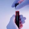 Что такое липаза в биохимическом анализе крови Ферментные препараты липаза